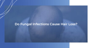 Do fungal infections cause hair loss?