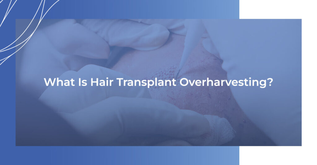 What is hair transplant overharvesting?