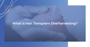 What is hair transplant overharvesting?