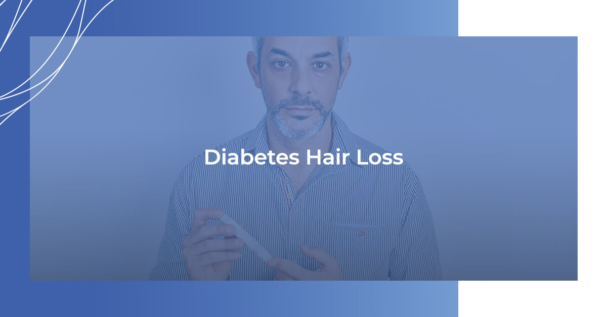 Diabetes Hair Loss