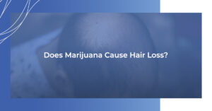 Does Marijuana Cause Hair Loss?