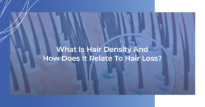 What is Hair Density and How Does It Relate to Hair Loss?