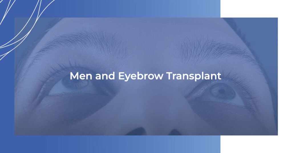 Men & eyebrow transplants