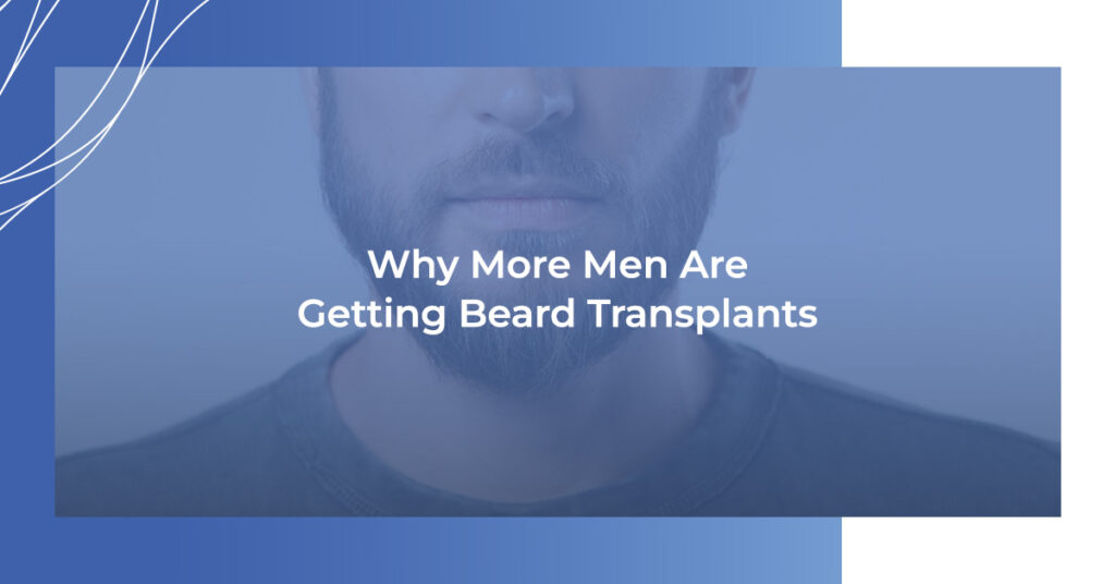 Why More Men Are Getting Beard Transplants